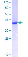 12.5% SDS-PAGE Stained with Coomassie Blue.